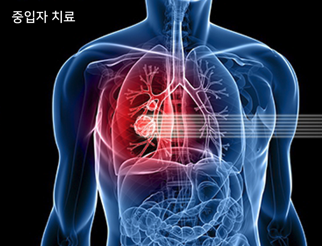 방사선의 종류에 따른 DNA 절단 차이